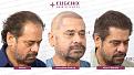 Haga clic en la imagen para ver una versión más grande

Nombre:	07776aaebd6e46ba6df54d25c4afd70be29669e5.jpg
Visitas:	5
Size:	51,5 KB
ID:	5243