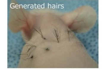 Tecnología práctica de regeneración capilar