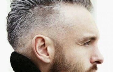 Alopecia común y canas tempranas factores asociados con riesgo de enfermedad cardíaca temprana