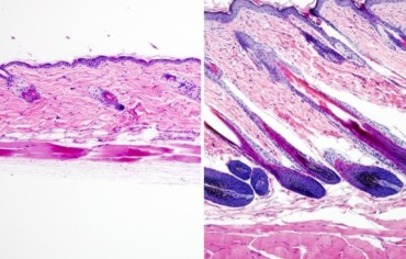 Activar las células madre para hacer crecer el cabello